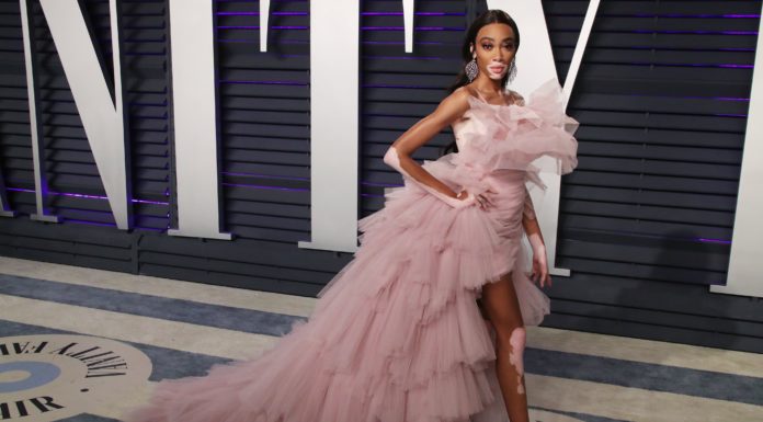 Winnie Harlow: The Queen of Neon Green